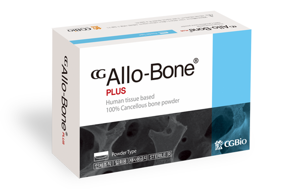 do bone image